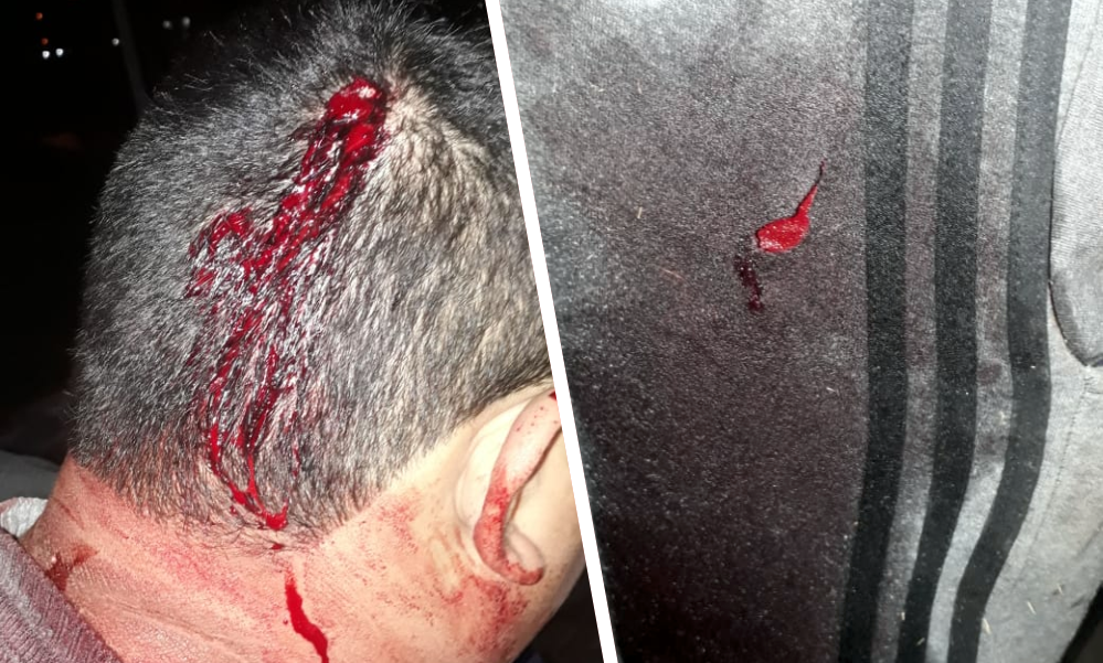 Guernica | Le robaron el arma e hirieron a un policía en el barrio Villa Numancia Sur