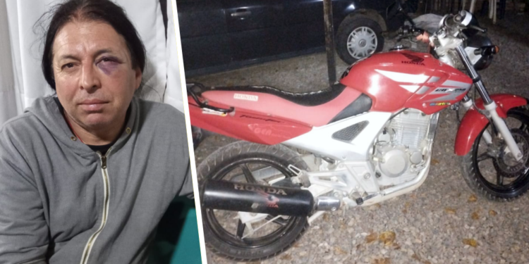 Guernica | Le roban la moto, lo golpean y le disparan dos tiros y la puede contar