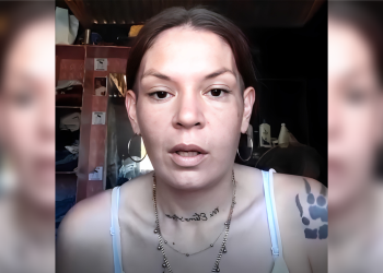 Solidaridad | San Vicente se une por Vale: una cruzada solidaria para recuperar su sonrisa