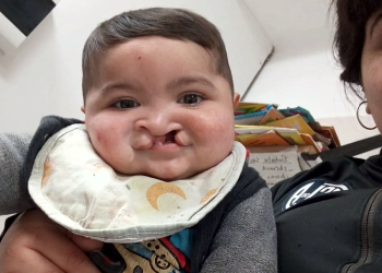 Solidaridad | Valentino, un bebé de Alejandro Korn necesita ocho millones de pesos para cirugías urgentes
