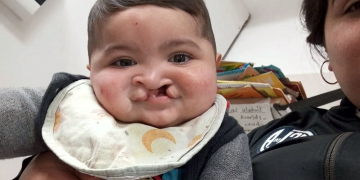Solidaridad | Valentino, un bebé de Alejandro Korn necesita ocho millones de pesos para cirugías urgentes